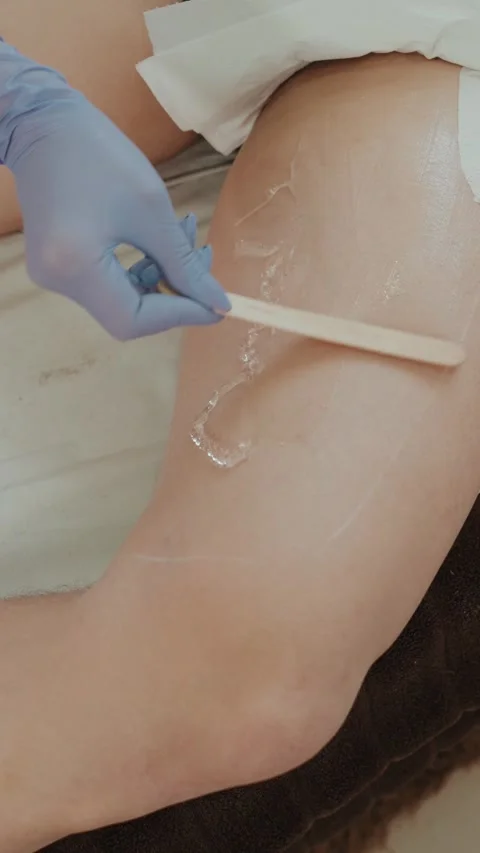 Gloved technician applying gel with spatula on leg before laser treatment 動画素材 333811070