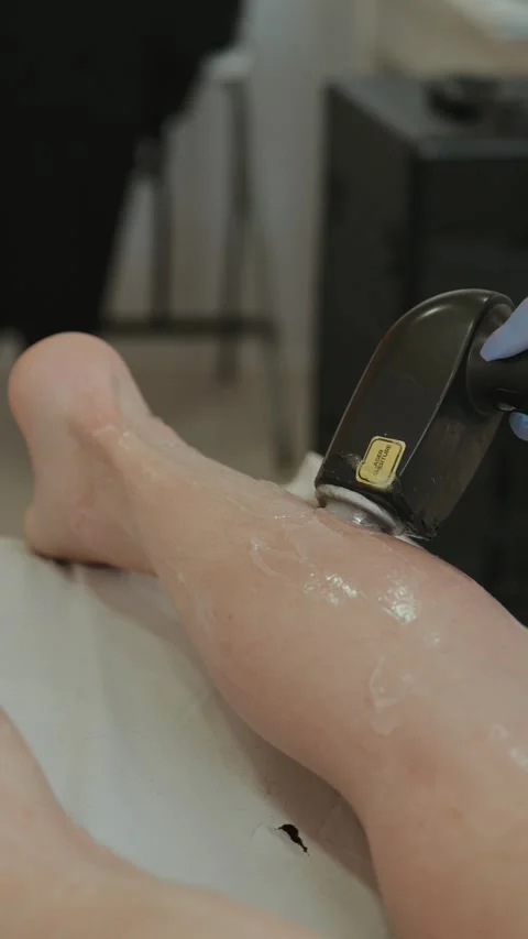 Gloved technician applying laser handpiece on gel-covered shin during hair Stock Footage 334694416