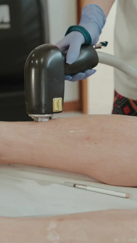Gloved technician moving laser handpiece above gel-covered arm in beauty clinic Stock Footage 334695142