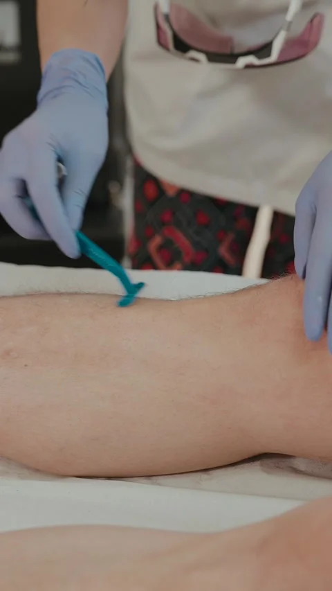 Gloved technician shaving leg with razor before laser hair removal treatment Stock Footage 333811150