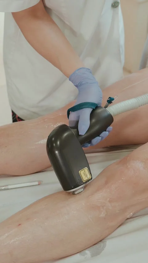 Gloved technician using laser device on client leg during hair removal session Stock Footage 334694754