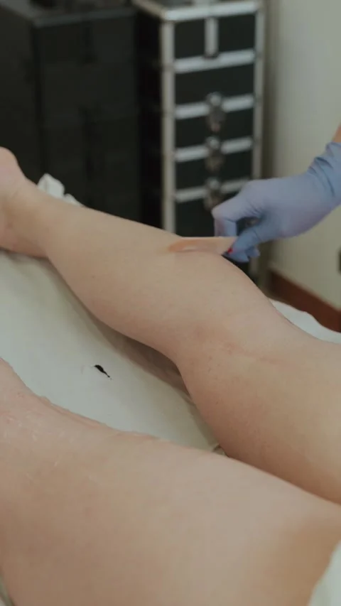 Gloved technician wiping gel off smooth legs after laser hair removal in clinic Stock Footage 334694557