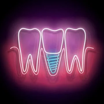 Glow Dentition with Implanted Tooth Stock Illustration