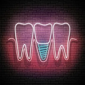 Glow Dentition with Implanted Tooth Illustrazione stock