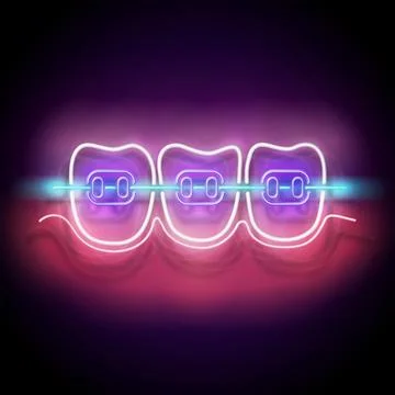 Glow Dentition with White Teeth and Braces Stock Illustration