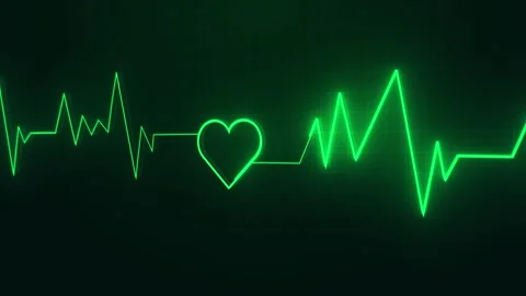 Glowing ECG heart pulse visual green waveform, medical grid, and dark healthcare Stock Footage 340572952