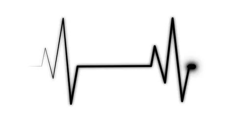 Glowing ECG Heartbeat Line Animation, A glowing electrocardiogram line on a.. Vidéo 305169611