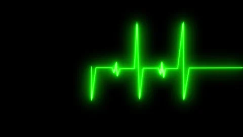 Glowing ecg heartbeat trace on grid background animation Stock Footage 335117064