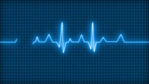 Glowing ecg heartbeat waveform on dark grid animation, Electrocardiogram wa.. Stock Footage 335117111