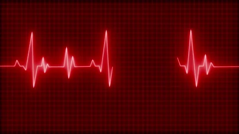 Glowing ecg heartbeat waveform on grid background animation, Electrocardiog.. Stock Footage 335116783