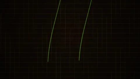 Glowing green lines on black background. Stock Footage 335519510