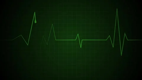 Glowing heartbeat line grid background medical pulse graph with a dramatic .. Stock Footage 340384342