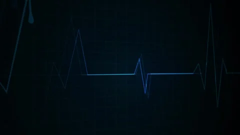 Glowing heartbeat line grid background medical pulse graph with a dramatic .. Stock Footage 340384377