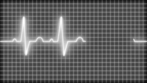 Glowing Heartbeat Waveform Line Animation, Glowing ECG Line on Black Grid B.. Видео 317853483