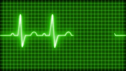 Glowing Heartbeat Waveform Line Animation, Glowing ECG Line on Black Grid B.. Vidéo 317853520