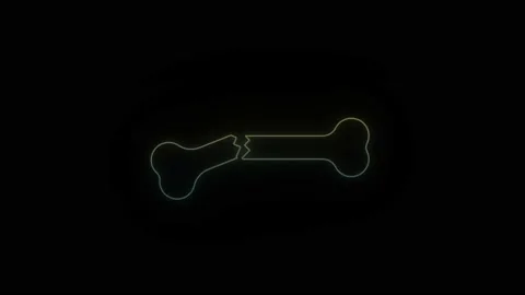 Glowing neon broken bone icon on black background. Stock Footage 194965774