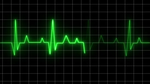 Glowing neon heartbeat plus animation. Cardiogram heartbeat icon animated video Stock Footage 307959338