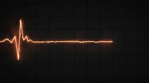 Glowing yellow fire Heart pulse monitor with signal. Electrocardiogram show.. Stock Footage 295933327
