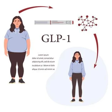GLP-1 hormone effect on weight loss with illustration of woman before and a.. Ilustración de archivo