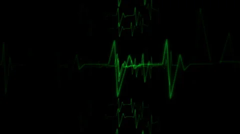 Golden Flakes Motion Mapping Видео 24719809