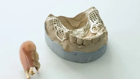 Golden teeth prosthesis Stock Footage 73721062