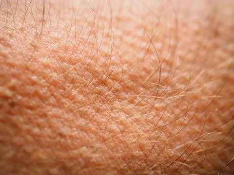 Goose bumps Stock Photos