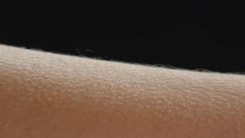 Goosebumps on skin Stock Footage 75604831