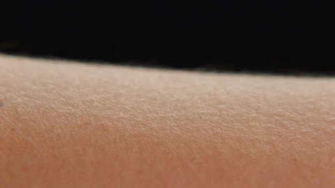Goosebumps on skin Stock Footage 75604859