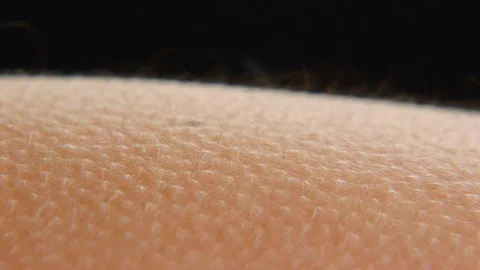 Goosebumps on skin Stock Footage 75604933