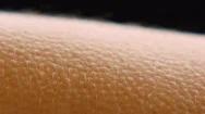 Goosebumps On Skin Stock Footage