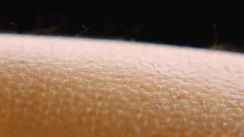 Goosebumps on skin Stock Footage 75605056