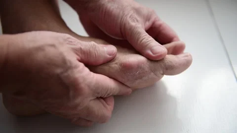 Gout pain. Video stock 212975043