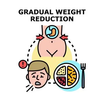 Gradual weight reduction process illustrating body transformation Stock Illustration