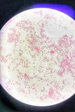 Gram negative bacilli bacteria in gram staining, Gram negative bacilli. Stock Photos