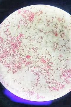 Gram negative bacilli bacteria in gram staining, Gram negative bacilli. Stock Photos
