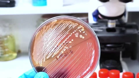 Gram-positive Staphylococcus growth on blood agar. Video stock 337722786