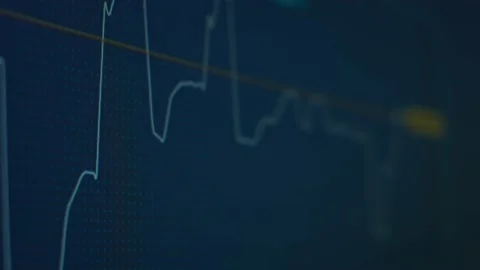 Graph of crypto currency online. Quotes of a currency at stock exchange. Rate Stock Footage 150065384