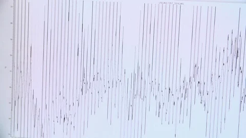 Graph on white chart Stock Footage 93528560