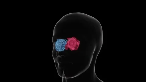 Graves' disease progression in the eyes refers to changes associated with Stock Footage 345125545
