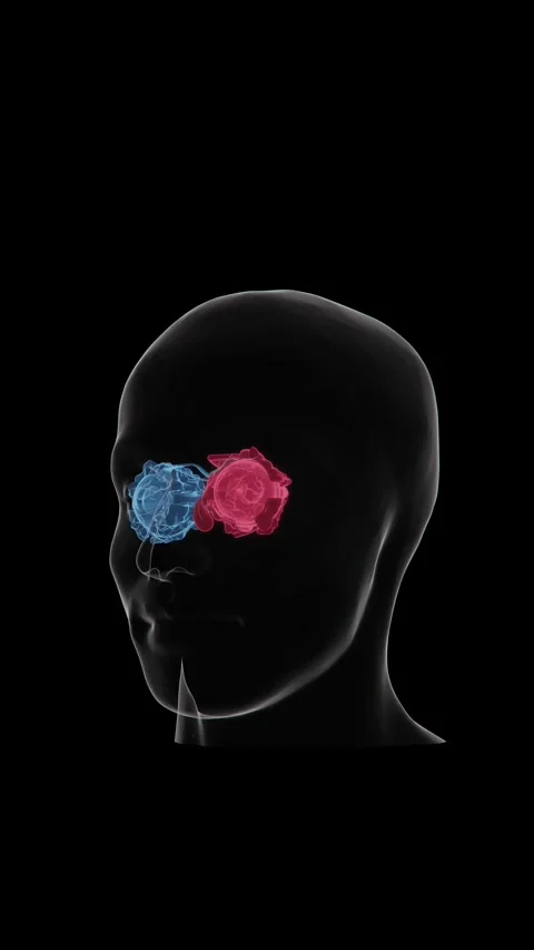 Graves' disease progression in the eyes refers to changes associated with Stock Footage 345125561