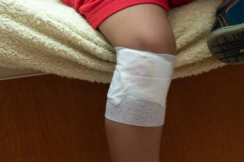 Grazed knee in the knee 스톡 사진