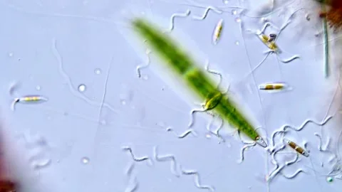 Green algae, Closterium algae under microscope view 库存影片 317790075