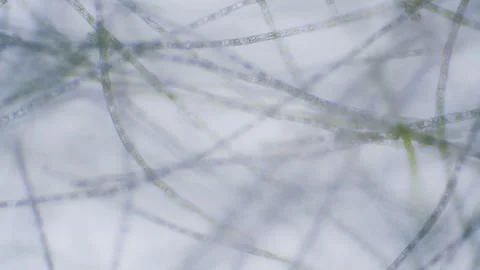 Green algae Stock Footage 313174146