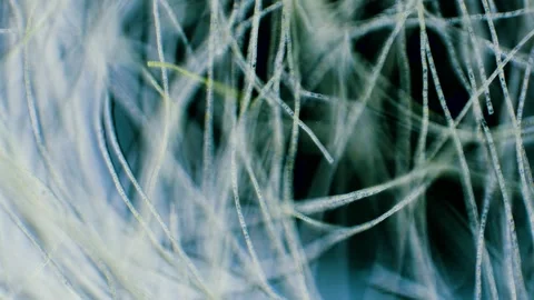 Green algae Stock Footage 313174795