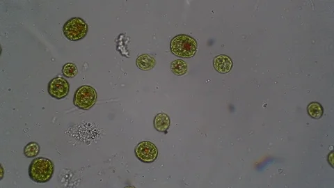 Green algae in a laboratory sample taken from the water of a pond at microscope Stock Footage 106995027