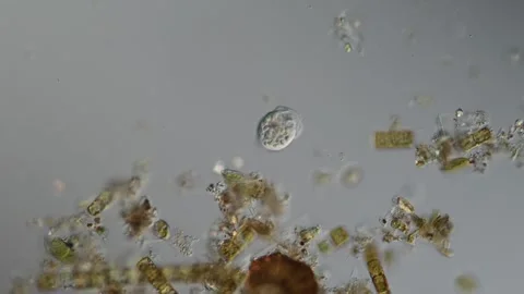 Green algae thread with growth of diatoms and bellfish 库存影片 340834415