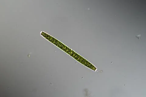 Green algae under the microscope 100x Stock Photos
