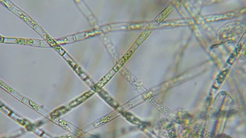 Green Algae Water Plant Under Microscope. Chloroplast Under Microscope. Cel.. Stock Footage 283183950