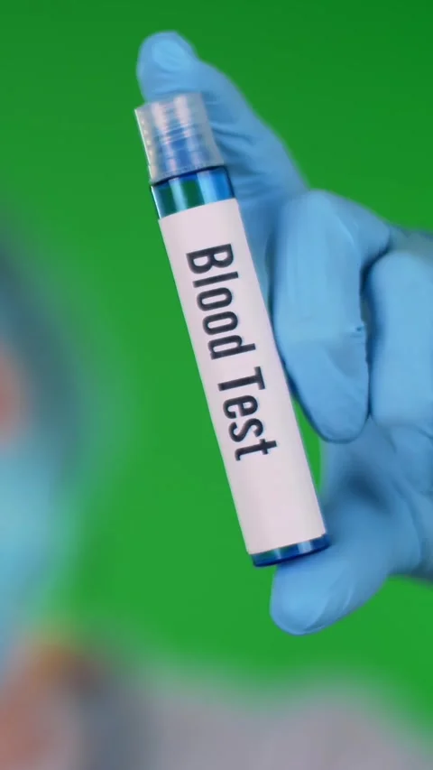 Green background. close-up, doctor's hand in blue medical glove holds test tube Stock Footage 319016696
