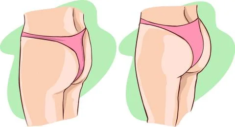 Green background Vector illustration of a buttocks implants Stock Illustration